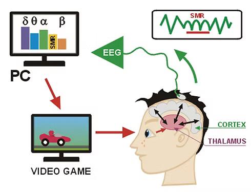 Diagrama ilustrativo con EEG, computadora, videojuego, corteza y tálamo